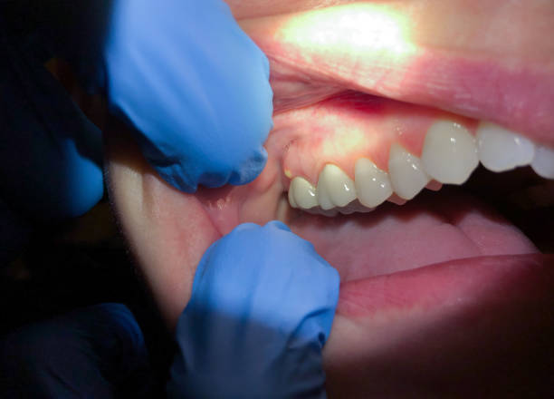 Best Emergency Dentist for Special Needs Patients in Lincoln Village, CA
