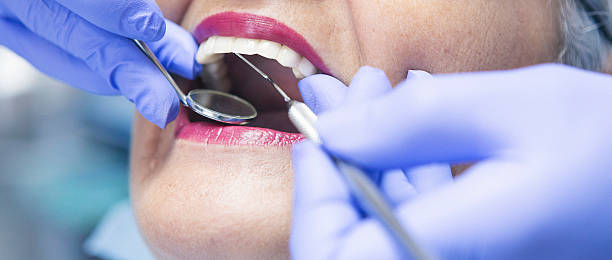 Best Emergency Dental Extractions in Lincoln Village, CA